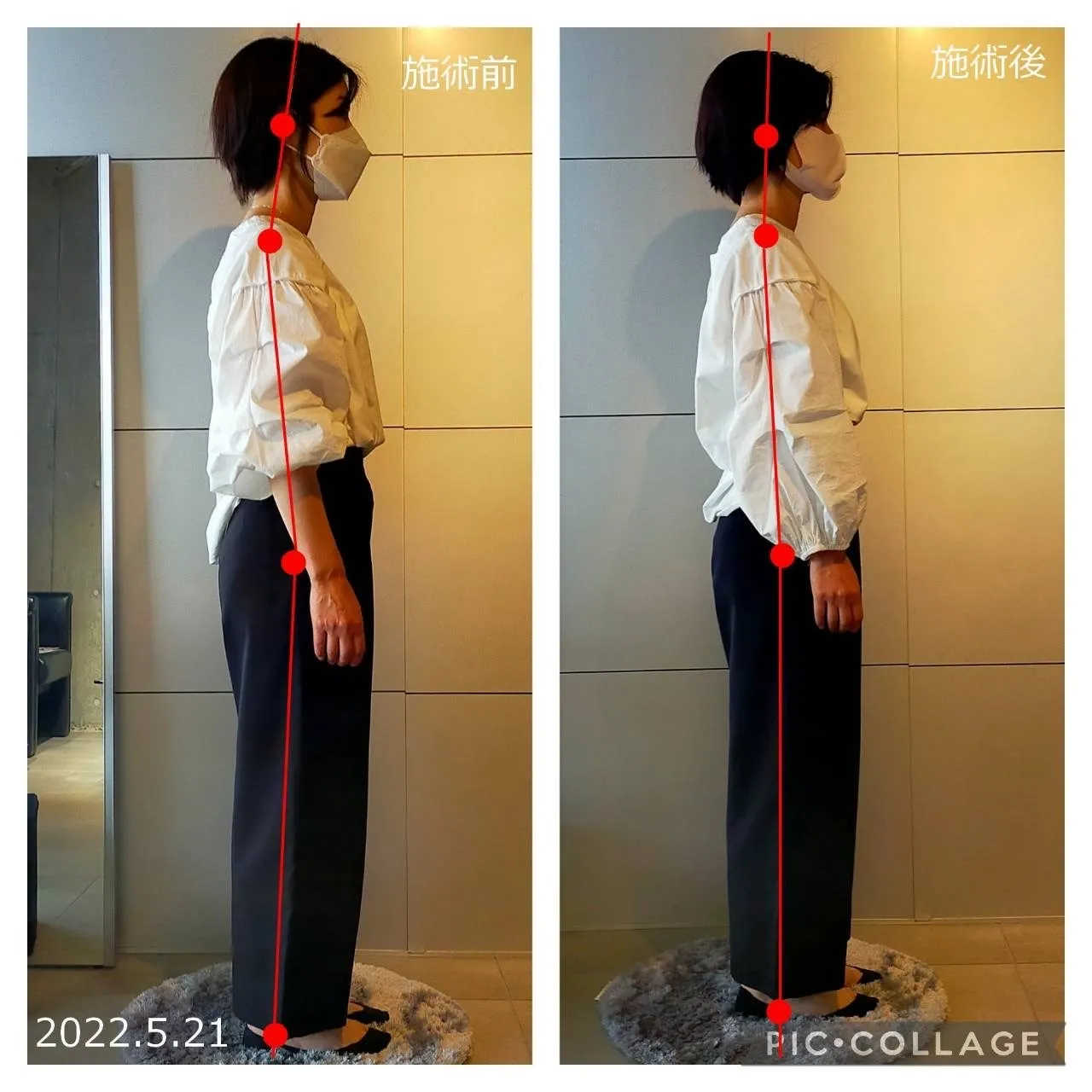 脳エステIRON45°ヒーリング