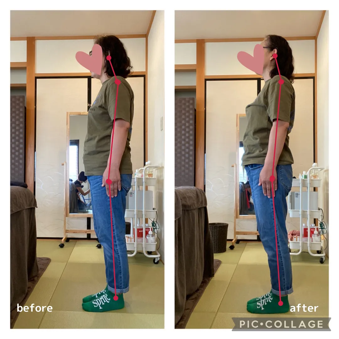 脳エステIRON45°ヒーリング